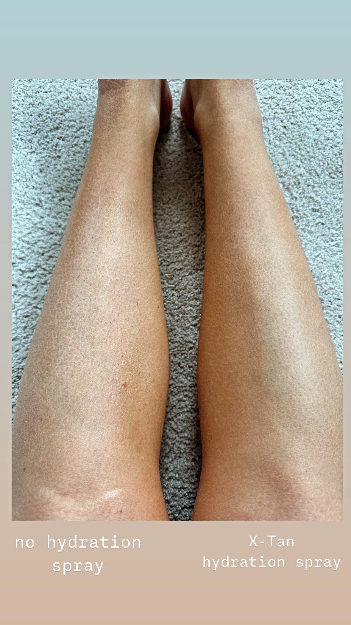 MIST - Hydration Spray for Post Spray Tanning - X - Tan Sunless